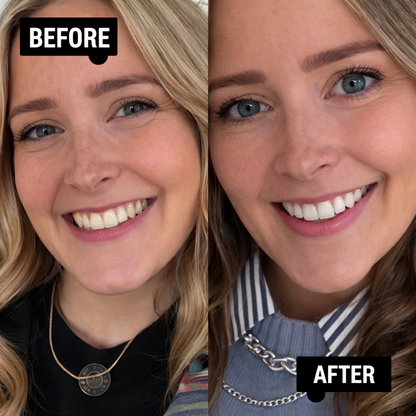 ICK Teeth Whitening Stick