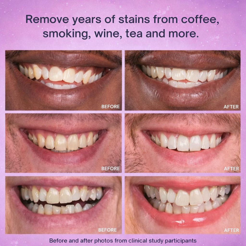 ICK Teeth Whitening Stick