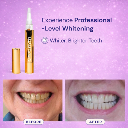 ICK Teeth Whitening Stick