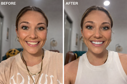 ICK Teeth Whitening Stick